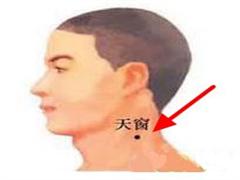 天窗