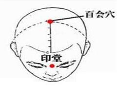 百会