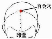 针灸减肥常用哪些穴位?这些事项要谨记