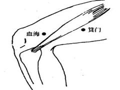 血海
