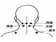 天柱