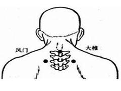 风门