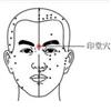 印堂
