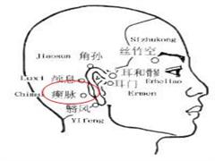  瘈脉