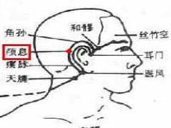 颅息