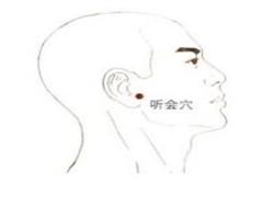 听会