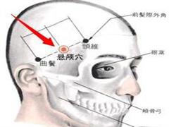 悬颅
