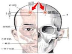 头临泣