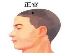 正营