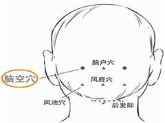 脑空