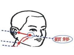 颧髎