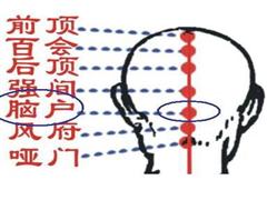 脑户