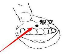 龈交