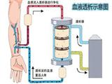 儿童尿毒症的饮食宜忌
