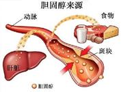 为什么高胆固醇和低胆固醇都对老年人不利
