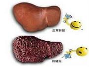肝硬化病人的饮食要注意什么
